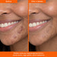 COMPOUND SKINTEREST Our Everything Bundle - AHA+Barrier+SPF