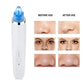 Electronic Vacuum Blackhead Remover