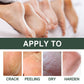 Anti-Crack Hand And Foot Care Cream Moisturizes Skin To Prevent Dry Cracking, Peeling, Freezing And Chapping