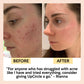 Face Toner with Hyaluronic Acid