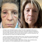 Pure + Simple Skin Kit for Sensitive Skin