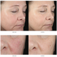 Medical-Grade Hyaluronic Acid Serum | Deep Hydration for All Skin Types