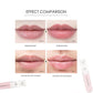 High Frequency Vibration Lip Massager Self Care Essentials