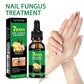 Ginger Nail Care Liquid Onychomycosis Fungus Repair Hand and Foot Nail Care